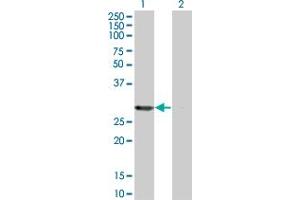 Western Blotting (WB) image for anti-Proteasome (Prosome, Macropain) Activator Subunit 2 (PA28 Beta) (PSME2) (AA 1-239) antibody (ABIN562498)
