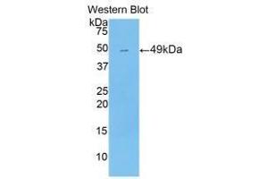 Western blot analysis of the recombinant protein. (NR1I2 Antikörper  (AA 205-390))