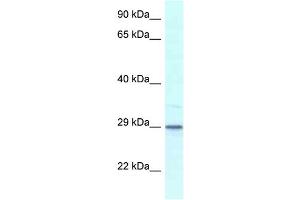 WB Suggested Anti-Kcnip3 Antibody   Titration: 1. (DREAM Antikörper  (Middle Region))