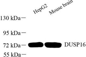Western blot analysis of DUSP16 (ABIN7073775) at dilution of 1: 1000 (DUSP16 Antikörper)