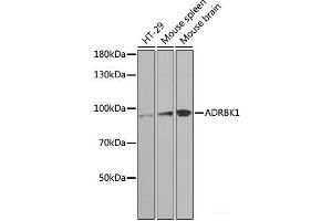 Western blot analysis of extracts of various cell lines using ADRBK1 Polyclonal Antibody at dilution of 1:1000. (GRK2 Antikörper)
