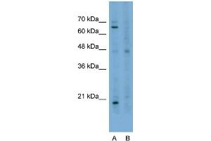 Host:  Rabbit  Target Name:  STAU1  Sample Type:  HepG2  Lane A:  Primary Antibody  Lane B:  Primary Antibody + Blocking Peptide  Primary Antibody Concentration:  2. (STAU1/Staufen Antikörper  (N-Term))