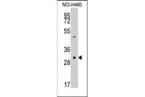 Western blot analysis of anti-CASP3 Pab in NCI-H460 cell line lysates (35ug/lane). (Caspase 3 Antikörper  (Middle Region))