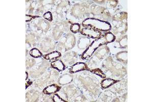 Immunohistochemistry (IHC) image for anti-Calcium-Sensing Receptor (CASR) (AA 874-1088) antibody (ABIN1678994)