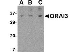 Image no. 1 for anti-ORAI Calcium Release-Activated Calcium Modulator 3 (ORAI3) (N-Term) antibody (ABIN203697) (ORAI3 Antikörper  (N-Term))