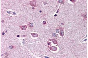Human Brain, Cortex (formalin-fixed, paraffin-embedded) stained with PTPN11 antibody ABIN214466 at 5 ug/ml followed by biotinylated goat anti-rabbit IgG secondary antibody ABIN481713, alkaline phosphatase-streptavidin and chromogen. (PTPN11 Antikörper  (N-Term))