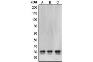 Western blot analysis of CBR1 expression in SHSY5Y (A), HeLa (B), MCF7 (C) whole cell lysates. (CBR1 Antikörper  (Center))