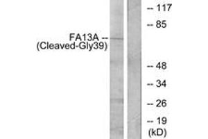 Western blot analysis of extracts from Jurkat cells, treated with etoposide 25uM 24h, using FA13A (Cleaved-Gly39) Antibody. (FA13A (AA 20-69), (Cleaved-Gly39) Antikörper)