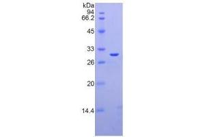 SDS-PAGE analysis of Rat Galectin 3 Protein. (Galectin 3 Protein (LGALS3))