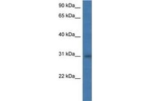 Image no. 1 for anti-Major Histocompatibility Complex, Class II, DM alpha (HLA-DMA) (AA 58-107) antibody (ABIN6746965) (HLA-DMA Antikörper  (AA 58-107))