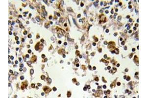 Immunohistochemistry analyzes of MSK1 antibody in paraffin-embedded human lymph node tissue. (MSK1 Antikörper)