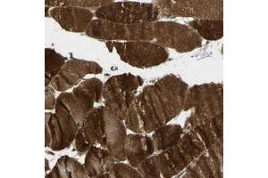 Immunohistochemical staining of human skeletal muscle with FLII polyclonal antibody  shows strong cytoplasmic positivity in myocytes at 1:20-1:50 dilution. (FLII Antikörper)
