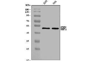 Western blot analysis of IGBP1 using anti-IGBP1 antibody (ABIN7601811).