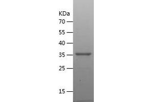 Western Blotting (WB) image for Dehydrogenase/reductase (SDR Family) Member 9 (DHRS9) (AA 18-319) protein (His tag) (ABIN7122624) (DHRS9 Protein (AA 18-319) (His tag))