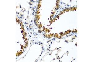 Immunohistochemistry of paraffin-embedded mouse lung using WWTR1 antibody at dilution of 1:200 (40x lens). (WWTR1 Antikörper)