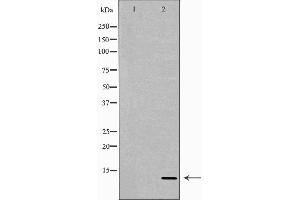Western blot analysis of extracts of Recombinant protein, using NRG4 antibody. (Neuregulin 4 Antikörper  (C-Term))
