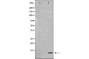 Apolipoprotein C-II Antikörper  (Internal Region)