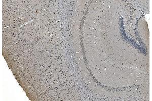 IHC analysis of LSM7 using anti-LSM7 antibody (ABIN7598937).