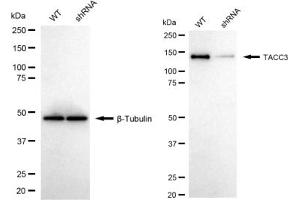 Western blotting analysis using TACC3 antibody (ABIN7800606).