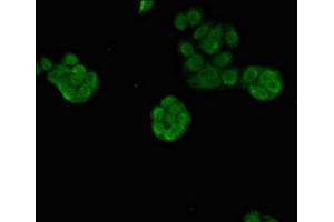 Immunofluorescent analysis of PC-3 cells using ABIN7164089 at dilution of 1:100 and Alexa Fluor 488-congugated AffiniPure Goat Anti-Rabbit IgG(H+L) (PRDM16 Antikörper  (AA 448-683))