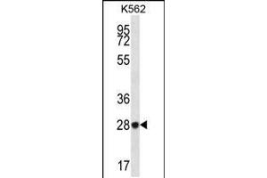 Western blot analysis in K562 cell line lysates (35ug/lane). (ZNF146 Antikörper  (N-Term))