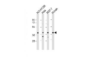 All lanes : Anti-TWF1 Antibody (Center) at 1:2000 dilution Lane 1: NCI- whole cell lysate Lane 2: Hela whole cell lysate Lane 3: MCF-7 whole cell lysate Lane 4: mouse brain lysate Lysates/proteins at 20 μg per lane. (TWF1 Antikörper  (AA 201-235))