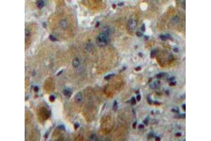 Used in DAB staining on fromalin fixed paraffin-embedded Liver tissue (MUC6 Antikörper  (AA 2338-2439))