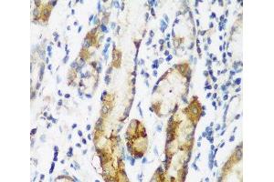 Immunohistochemistry of paraffin-embedded Human gastric using NAA60 Polyclonal Antibody at dilution of 1:200 (40x lens). (NAT15 Antikörper)