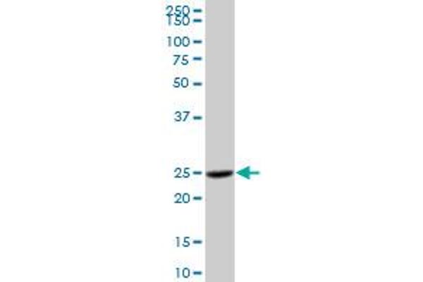 Cathepsin H Antikörper  (AA 1-335)