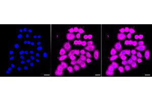Immunocytochemical staining of HepG2 cells with HINT1 antibody (ABIN7798917), 1:1,000).