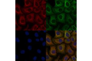 ABIN6259290 and ABIN6276141 staining Hela cells by IF/ICC.