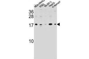 Western Blotting (WB) image for anti-S100 Calcium Binding Protein Z (S100Z) antibody (ABIN2995739) (S100Z Antikörper)