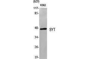Western Blot (WB) analysis of specific cells using SYT Polyclonal Antibody. (SS18 Antikörper  (N-Term))