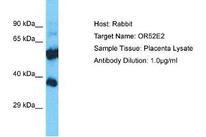 Host: Rabbit Target Name: OR52E2 Sample Type: Placenta lysates Antibody Dilution: 1. (OR52E2 Antikörper  (C-Term))