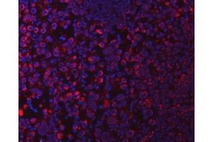 IF analysis of SUCLG1 using anti-SUCLG1 antibody (ABIN7600906). (SUCLG1 Antikörper  (AA 25-346))