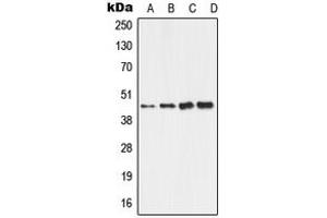Western blot analysis of ALDH3B2 expression in HepG2 (A), HeLa (B), Raw264.