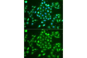 Immunofluorescence analysis of  cells using UCHL5 antibody (ABIN6132764, ABIN6149872, ABIN6149874 and ABIN6223990). (UCHL5 Antikörper  (AA 1-328))