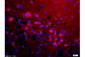 Formalin-fixed and paraffin-embedded rat brain labeled with Anti-KMT8/Riz1/Riz2 Polyclonal Antibody, Unconjugated (ABIN763001) 1:200, overnight at 4°C, The secondary antibody was Goat Anti-Rabbit IgG, Cy3 conjugated used at 1:200 dilution for 40 minutes at 37°C. (PRDM2 Antikörper  (AA 1201-1300))