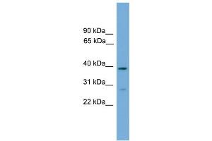 WB Suggested Anti-NCF4 Antibody Titration: 0. (NCF4 Antikörper  (C-Term))