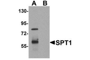 Western blot analysis of TYW1 in human lung tissue lysate with TYW1 antibody at 1 μg/ml.