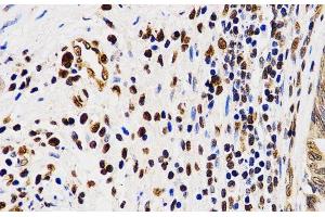 Immunohistochemistry (Paraffin-embedded Sections) (IHC (p)) image for anti-Histone H4 (H4R3me2a) antibody (ABIN7260410)