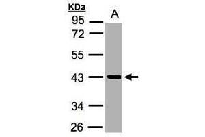 WB Image Sample (30μg whole cell lysate) A:MOLT4 , 10% SDS PAGE antibody diluted at 1:2000 (Kallikrein 11 Antikörper)