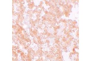 Immunohistochemical staining of rat lung cells with MFSD2 polyclonal antibody  at 5 ug/mL. (MFSD2A Antikörper  (C-Term))