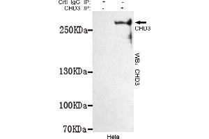 Immunoprecipitation analysis of Hela cell lysates using CHD3 mouse mAb. (CHD3 Antikörper  (C-Term))