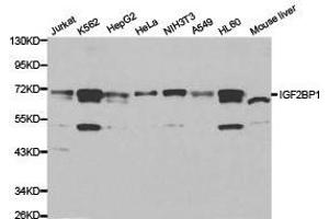 Western Blotting (WB) image for anti-Insulin-Like Growth Factor 2 mRNA Binding Protein 1 (IGF2BP1) antibody (ABIN1873165)