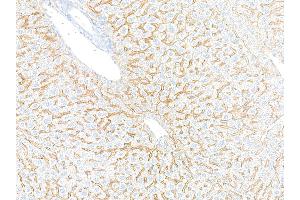 Immunohistochemistry (IHC) image for anti-Epidermal Growth Factor Receptor (EGFR) (C-Term) antibody (ABIN7795642) (Rekombinanter EGFR Antikörper  (C-Term))