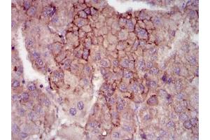 Immunohistochemistry (IHC) image for anti-Maternal Embryonic Leucine Zipper Kinase (MELK) antibody (ABIN1108210) (MELK Antikörper)