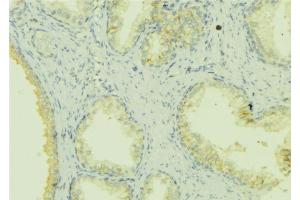 ABIN6272851 at 1/100 staining Mouse colon tissue by IHC-P. (SHARPIN Antikörper  (Internal Region))
