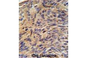 Immunohistochemistry (IHC) image for anti-Heat Shock 70kDa Protein 5 (Glucose-Regulated Protein, 78kDa) (HSPA5) antibody (ABIN3002214) (GRP78 Antikörper)
