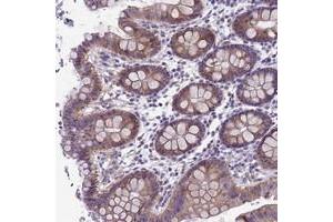 Immunohistochemical staining of human colon with KIAA1407 polyclonal antibody  shows moderate cytoplasmic positivity in glandular cells at 1:20-1:50 dilution. (KIAA1407 Antikörper)